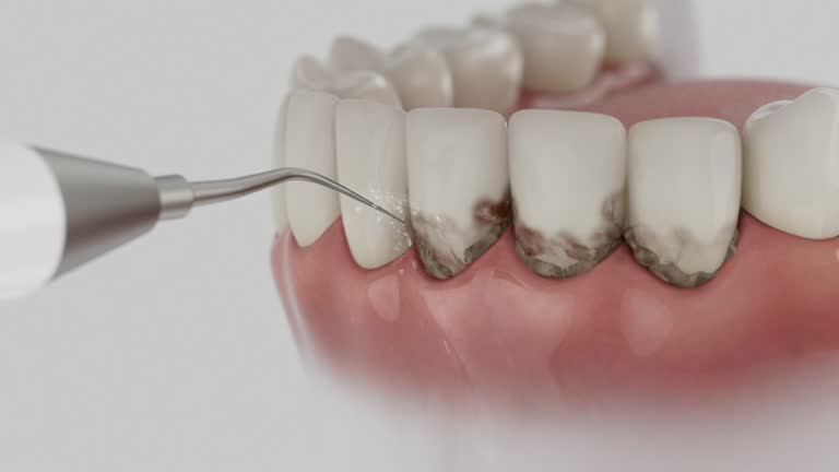 Reliable Dental Implants contractor in Gap, PA by Smile Center Dentistry